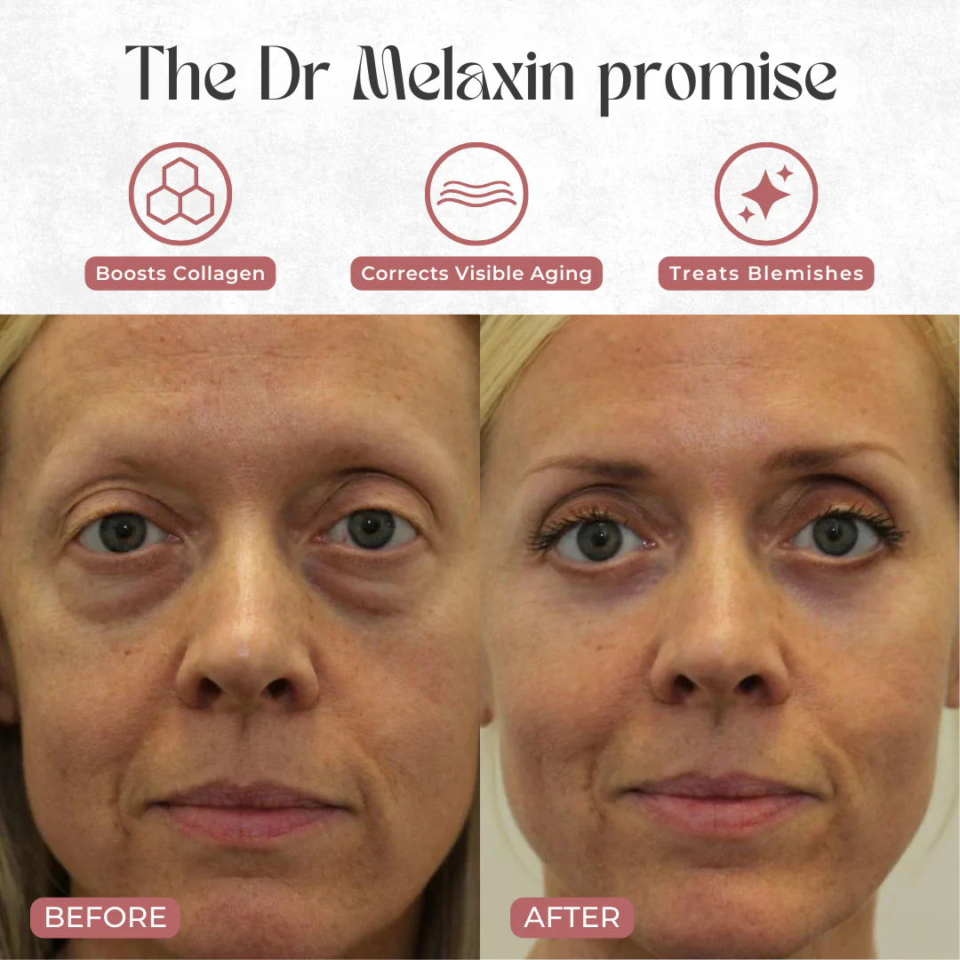 VibraGlow - LED Eye Lifting Cream YCZ