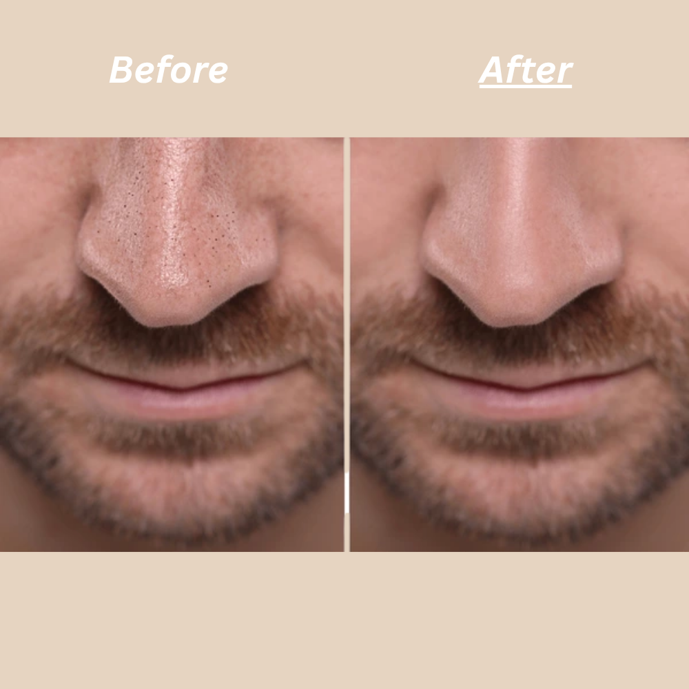 RicePeel – Men's Exfoliating Glow Serum