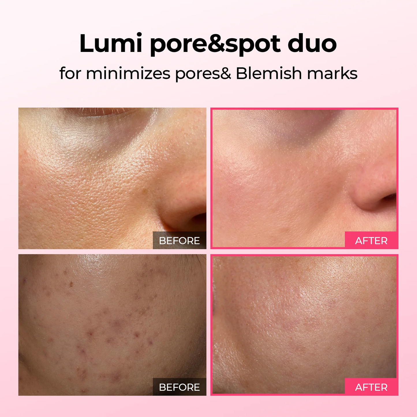Pack - Pore & Spot Duo