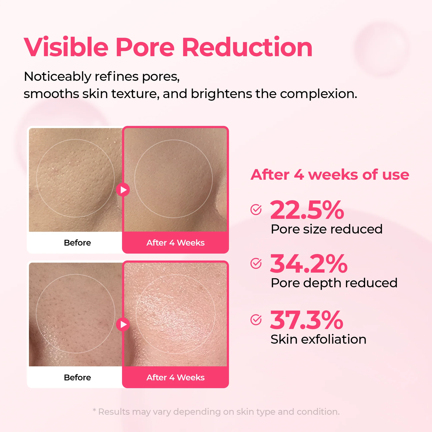 Pack - Pore & Spot Duo