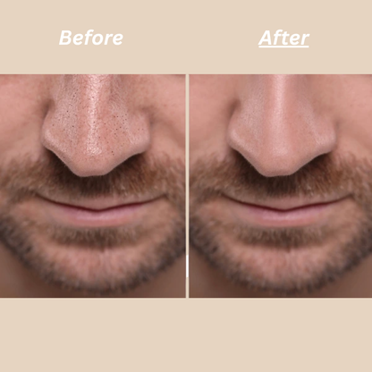 RicePeel – Men's Exfoliating Glow Serum