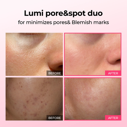 Pack - Pore & Spot Duo